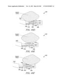 POWERED TISSUE MODIFICATION DEVICES AND METHODS diagram and image