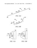 POWERED TISSUE MODIFICATION DEVICES AND METHODS diagram and image