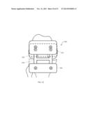 Combined Measured Resection Methods and Instruments for Knee Arthroplasty diagram and image