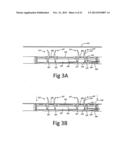 Clip for Implant Deployment Device diagram and image