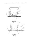 Clip for Implant Deployment Device diagram and image