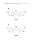 Clip for Implant Deployment Device diagram and image