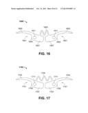 Clip for Implant Deployment Device diagram and image