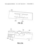 Clip for Implant Deployment Device diagram and image