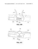 Clip for Implant Deployment Device diagram and image