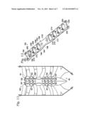 CERCLAGE SYSTEM FOR BONE diagram and image