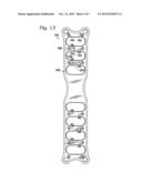 CERCLAGE SYSTEM FOR BONE diagram and image