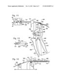 CERCLAGE SYSTEM FOR BONE diagram and image