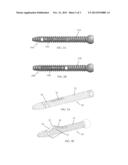 EXPANDABLE BONE FIXATION ELEMENT diagram and image