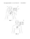 Extracorporeal Unit for Inspecting the Insulation of an Electrical Wire of     an Implanted Medical Device diagram and image