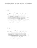 RETINAL PROSTHESIS SYSTEM USING NANOWIRE LIGHT DETECTOR, AND MANUFACTURING     METHOD THEREOF diagram and image