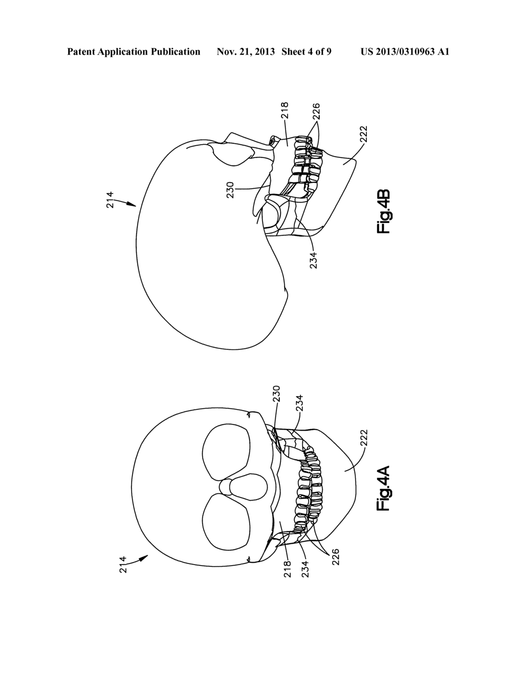 METHOD OF SURGICAL PLANNING - diagram, schematic, and image 05