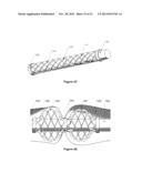 Methods And Apparatus For Occlusion Of Body Lumens diagram and image