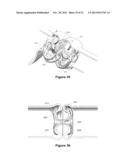 Methods And Apparatus For Occlusion Of Body Lumens diagram and image