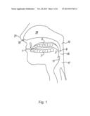 APPARATUS AND METHODS FOR THE TREATMENT OF SLEEP APNEA diagram and image