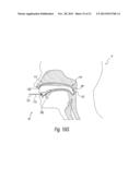 APPARATUS AND METHODS FOR THE TREATMENT OF SLEEP APNEA diagram and image