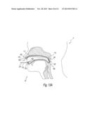 APPARATUS AND METHODS FOR THE TREATMENT OF SLEEP APNEA diagram and image