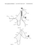 Beverage Can Marketing Device diagram and image