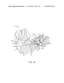 EARDRUM IMPLANTABLE DEVICES FOR HEARING SYSTEMS AND METHODS diagram and image