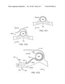 EARDRUM IMPLANTABLE DEVICES FOR HEARING SYSTEMS AND METHODS diagram and image