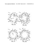 DIFFUSER HAVING DETACHABLE VANES WITH POSITIVE LOCK diagram and image