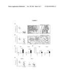 Cross Protective Epitopes of Aspergillus Fumigatus and Candida Albicans diagram and image