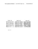 GENETIC AMPLIFICATION OF IQGAPI IN CANCER diagram and image