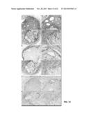 GENERATION OF NOVEL BONE FORMING CELLS (MONOOSTEOPHILS) FROM LL-37 TREATED     MONOCYTES diagram and image