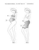 Systems and Methods for Inhibiting Formation of Stretch Marks diagram and image