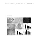 Parenteral Composition Comprising Microspheres With a Diameter Between 10     And 20 Microns diagram and image