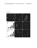 Parenteral Composition Comprising Microspheres With a Diameter Between 10     And 20 Microns diagram and image