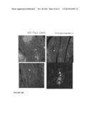 Parenteral Composition Comprising Microspheres With a Diameter Between 10     And 20 Microns diagram and image