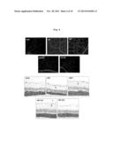 PHARMACEUTICAL COMPOSITION FOR PREVENTING AND TREATING COMPLICATIONS OF     DIABETES CONTAINING A TRADITIONAL ORIENTAL MEDICINE EXTRACT OR A FRACTION     THEREOF AS AN ACTIVE INGREDIENT diagram and image