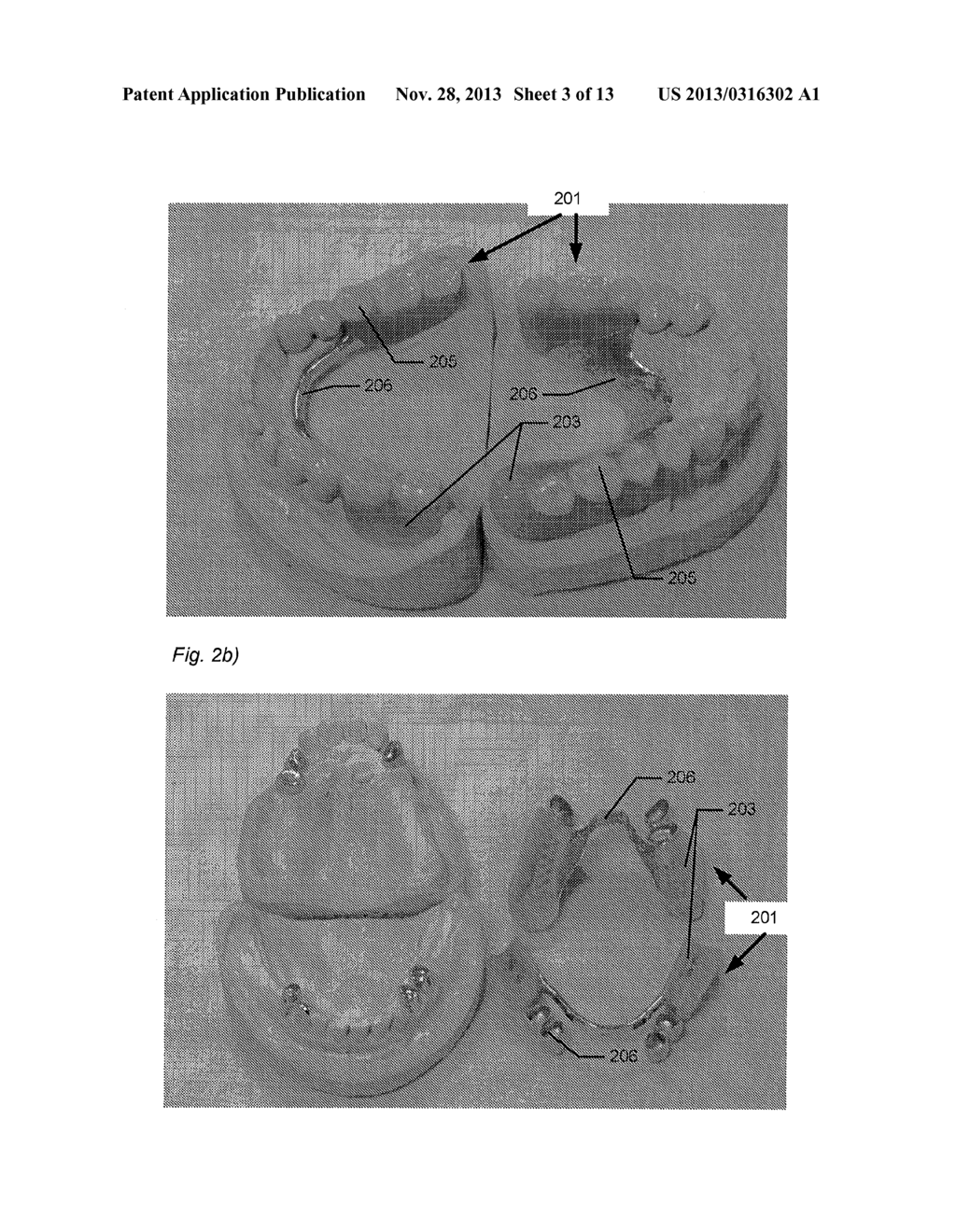 MODELING AND MANUFACTURING OF DENTURES - diagram, schematic, and image 04