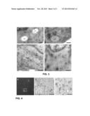 Method of Preparing a Biological Sample for Inspection with Electron     Microscopy and Fluorescent Light Microscopy diagram and image