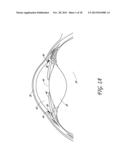 DRUG SCREENING METHOD, COMPOSITIONS AND METHODS OF TREATING GLAUCOMA diagram and image