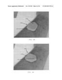 MULTI-POLAR MAGNETIC DEVICES FOR TREATING PATIENTS AND METHODS THEREFOR diagram and image