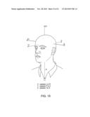 TRANSCRANIAL MAGNETIC STIMULATION FOR IMPROVED ANALGESIA diagram and image