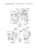 TRANSCRANIAL MAGNETIC STIMULATION FOR IMPROVED ANALGESIA diagram and image