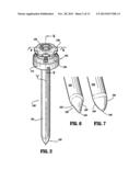 OPTICAL TROCAR WITH SCOPE HOLDING ASSEMBLY diagram and image