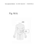 PORTABLE REGULATED VACUUM PUMP FOR MEDICAL PROCEDURES diagram and image