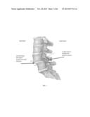 ACTUATABLE RETRACTOR diagram and image