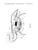 NONINVASIVE MEASUREMENTS IN A HUMAN BODY diagram and image