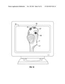 SOFT TISSUE CUTTING INSTRUMENT AND METHOD OF USE diagram and image