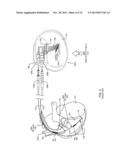 IMPLANTABLE CARDIOVERTER DEFIBRILLATOR DESIGNED FOR USE IN A MAGNETIC     RESONANCE IMAGING ENVIRONMENT diagram and image