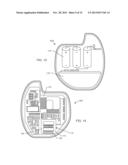 IMPLANTABLE CARDIOVERTER DEFIBRILLATOR DESIGNED FOR USE IN A MAGNETIC     RESONANCE IMAGING ENVIRONMENT diagram and image