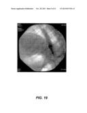 OPACITY TECHNOLOGY diagram and image