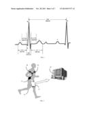 Generative Model-Driven Resource-Efficient Monitoring in Body Sensor     Networks diagram and image