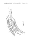 VALVE APERTURE SIZING DEVICES AND METHODS diagram and image