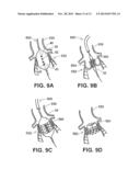 VALVE APERTURE SIZING DEVICES AND METHODS diagram and image